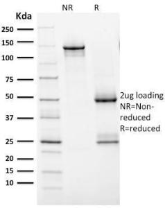 SDS-PAGE analysis of Anti-HER2 Antibody [ERBB2/2452] under non-reduced and reduced conditions; showing intact IgG and intact heavy and light chains, respectively. SDS-PAGE analysis confirms the integrity and purity of the antibody