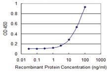 Anti-MBTPS2 Mouse Monoclonal Antibody [clone: 1A3]