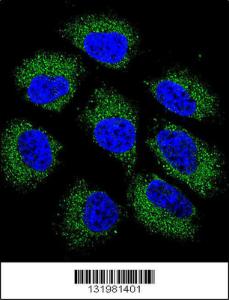 Anti-GSR Rabbit Polyclonal Antibody (AP (Alkaline Phosphatase))