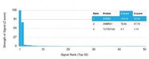 Analysis of protein array containing more than 19000 full-length human proteins using Anti-HER2 Antibody [ERBB2/2452]