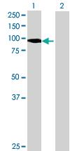 Anti-PTPN22 Mouse Polyclonal Antibody