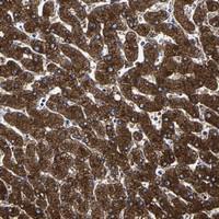 Anti-AASS Rabbit Polyclonal Antibody