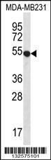 Anti-GPR34 Rabbit Polyclonal Antibody (AP (Alkaline Phosphatase))