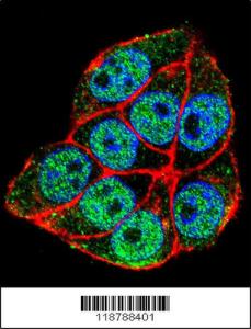 Anti-TRADD Rabbit Polyclonal Antibody (APC (Allophycocyanin))