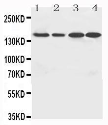 Anti-ROCK2 Rabbit Polyclonal Antibody