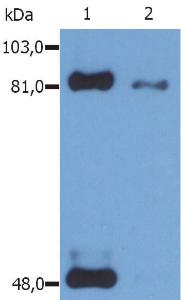 Western Blotting analysis (reducing conditions) of phosphorylated STAT1 (Ser727) in IFN-gamma treated HeLa human cervix carcinoma cell line using Anti-STAT1 (Phospho-Ser727) Antibody (A86741). Lane 1: Immunoprecipitated material by Anti-STAT1 Antibody [SM2]. Lane 2: Original whole cell lysate