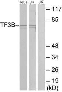 Western blot analysis of lysates from HeLa and Jurkat cells using Anti-TF3B Antibody. The right hand lane represents a negative control, where the antibody is blocked by the immunising peptide