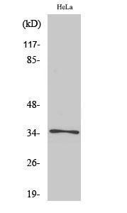 Western blot analysis of various cells using Anti-OR52E6 Antibody