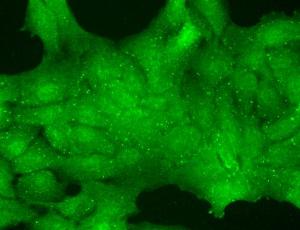 Immunocytochemistry/Immunofluorescence analysis of human HaCaT cells, fixed in cold 100% methanol for 10 minutes at -20°C, using Anti-TRP 7 Antibody [N64A/36] (A304950), at 1:100 for 1 hour at room temperatur