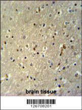 Anti-TTC26 Rabbit Polyclonal Antibody (PE (Phycoerythrin))