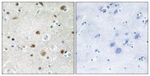 Immunohistochemical analysis of paraffin-embedded human brain tissue using Anti-TF3B Antibody. The right hand panel represents a negative control, where the antibody was pre-incubated with the immunising peptide