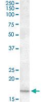 Anti-CXCL2 Goat Polyclonal Antibody