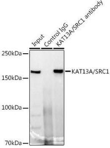 Immunoprecipitation analysis of 300 µg extracts of 293T cells using 3 µg of Anti-KAT13A / SRC1 Antibody [ARC1395] (A309015). This Western blot was performed on the immunoprecipitate using Anti-KAT13A / SRC1 Antibody [ARC1395] (A309015) at a dilution of 1:1000