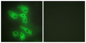 Immunofluorescence analysis of HeLa cells using Anti-JIP2 Antibody. The right hand panel represents a negative control, where the Antibody was pre-incubated with the immunising peptide