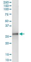 Anti-SLA2 Polyclonal Antibody Pair