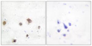 Immunohistochemical analysis of paraffin-embedded human brain tissue using Anti-JIP2 Antibody. The right hand panel represents a negative control, where the Antibody was pre-incubated with the immunising peptide