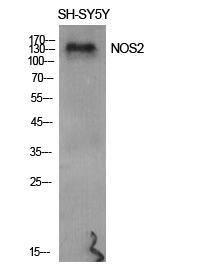 Anti-iNOS antibody