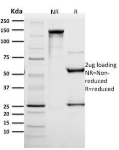 SDS-PAGE analysis of Anti-HER2 Antibody [SPM172] under non-reduced and reduced conditions; showing intact IgG and intact heavy and light chains, respectively. SDS-PAGE analysis confirms the integrity and purity of the Antibody