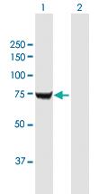 Anti-IGF2BP2 Mouse Polyclonal Antibody