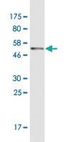 Anti-SERPINC1 Mouse Monoclonal Antibody [clone: 3G9]