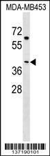 Anti-NECAB2 Rabbit Polyclonal Antibody (FITC (Fluorescein Isothiocyanate))