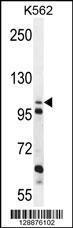 Anti-ZGRF1 Rabbit Polyclonal Antibody (PE (Phycoerythrin))