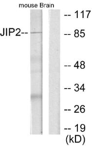 Western blot analysis of lysates from mouse brain using Anti-JIP2 Antibody. The right hand lane represents a negative control, where the Antibody is blocked by the immunising peptide