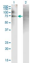 Anti-PJA2 Mouse Monoclonal Antibody [clone: 1G11]