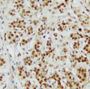 Anti-CTBP2 Rabbit Polyclonal Antibody