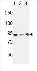 Anti-DNAJC6 Rabbit Polyclonal Antibody