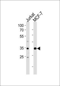 Anti-ATF4 Rabbit Polyclonal Antibody (Biotin)