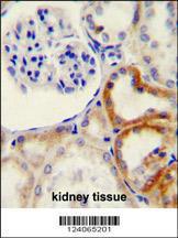 Anti-HYAL2 Rabbit Polyclonal Antibody (FITC (Fluorescein Isothiocyanate))