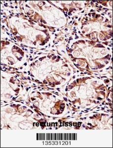 Anti-FXYD5 Rabbit Polyclonal Antibody (HRP (Horseradish Peroxidase))