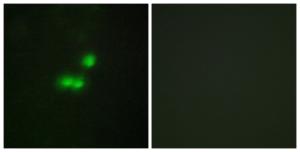 Immunofluorescence analysis of MCF7 cells using Anti-TF3B Antibody. The right hand panel represents a negative control, where the antibody was pre-incubated with the immunising peptide