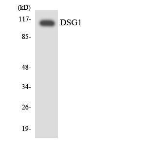 Western blot analysis of the lysates from 293 cells using Anti-DSG1 Antibody