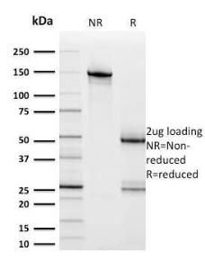 SDS-PAGE analysis of Anti-HER2 Antibody [ERBB2/2453] under non-reduced and reduced conditions; showing intact IgG and intact heavy and light chains, respectively. SDS-PAGE analysis confirms the integrity and purity of the antibody