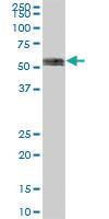 Anti-IGF2BP2 Mouse Polyclonal Antibody