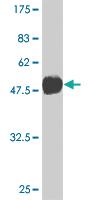 Anti-TBX3 Mouse Monoclonal Antibody [clone: 3A10]