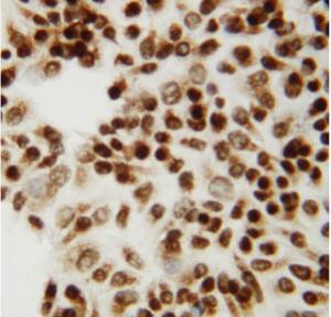 Anti-CTBP2 Rabbit Polyclonal Antibody