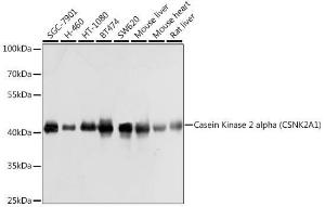 Western blot analysis of extracts of various cell lines, using Anti-CSNK2A1 Antibody (A307776) at 1:1,000 dilution. The secondary antibody was Goat Anti-Rabbit IgG H&L Antibody (HRP) at 1:10,000 dilution.