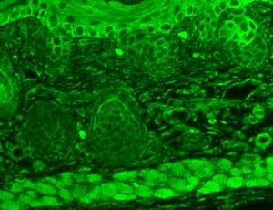 Immunohistochemistry analysis of mouse backskin, fixed in Bouin's fixative solution and paraffin-embedde