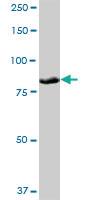 Anti-PLOD3 Mouse Polyclonal Antibody