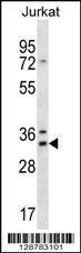 Anti-DNAJC9 Rabbit Polyclonal Antibody (AP (Alkaline Phosphatase))