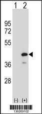 Anti-PTPN18 Rabbit Polyclonal Antibody (AP (Alkaline Phosphatase))