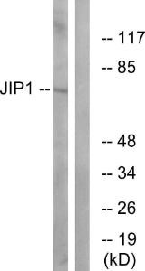 Western blot analysis of lysates from COLO205 cells, treated with Serum 20% 15' using Anti-JIP1 Antibody The right hand lane represents a negative control, where the antibody is blocked by the immunising peptide