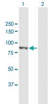 Anti-PLOD3 Mouse Polyclonal Antibody