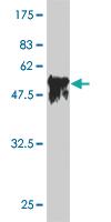 Anti-SERPINC1 Mouse Monoclonal Antibody [clone: 2B12]