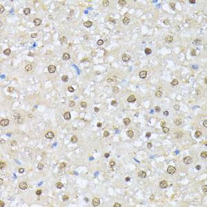 Immunohistochemistry analysis of paraffin-embedded rat liver using Anti-CSNK2A1 Antibody (A307776) at a dilution of 1:100 (40x lens). Perform microwave antigen retrieval with 10 mM PBS buffer pH 7.2 before commencing with IHC staining protocol.