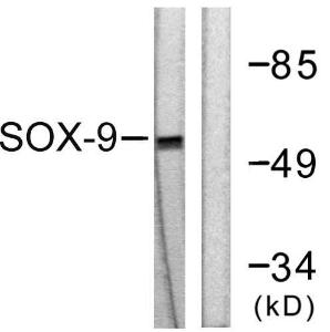 Western blot analysis of lysates from 293 cells, treated with PBS 60' using Anti-SOX9 Antibody The right hand lane represents a negative control, where the antibody is blocked by the immunising peptide