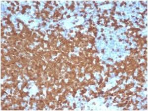 Anti-ZAP70 antibody